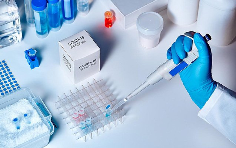 Azərbaycanda daha 57 nəfərdə koronavirus aşkarlandı - 68-i sağaldı