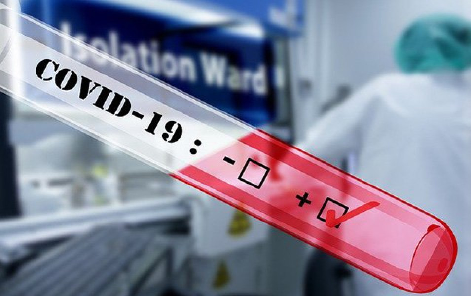 Daha 438 nəfərdə koronavirus aşkarlandı - 4 nəfər vəfat etdi