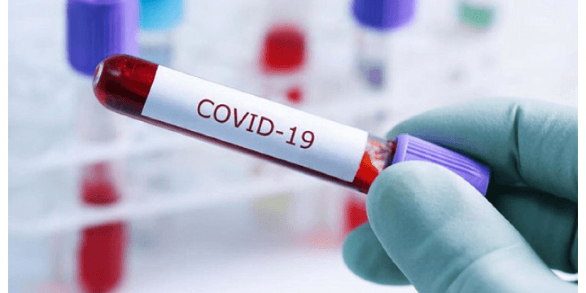 Daha 471 nəfər koronavirusa yoluxub və 5 nəfər ölüb