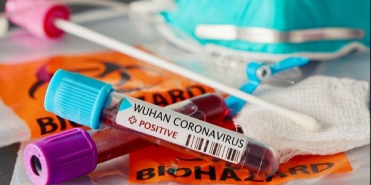 321 nəfər koronavirusa yoluxdu, 535 nəfər sağaldı