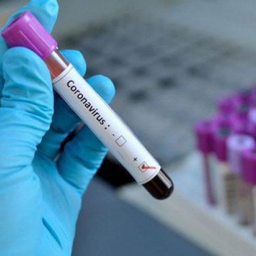 Azərbaycanda daha 38 nəfərdə koronavirus tapıldı - 30 nəfər sağaldı