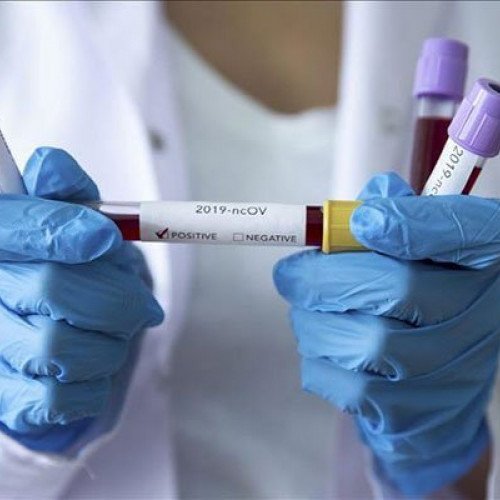 Azərbaycanda daha 143 nəfər koronavirusa yoluxdu - 3 nəfər öldü, 44 nəfər sağaldı