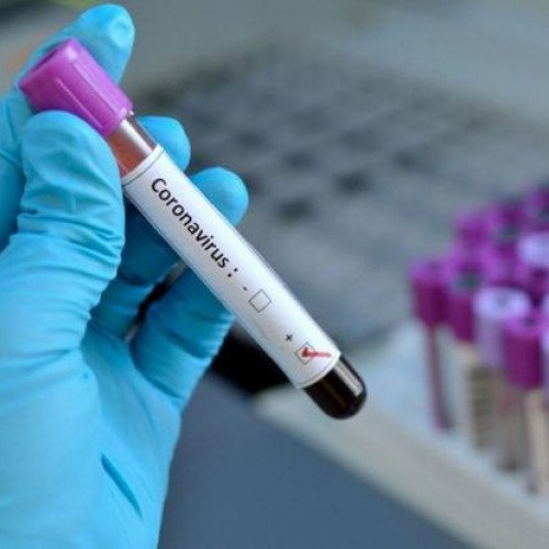 Azərbaycan Respublikasında 33 yeni koronavirus infeksiyasına yoluxma faktı qeydə alınıb.