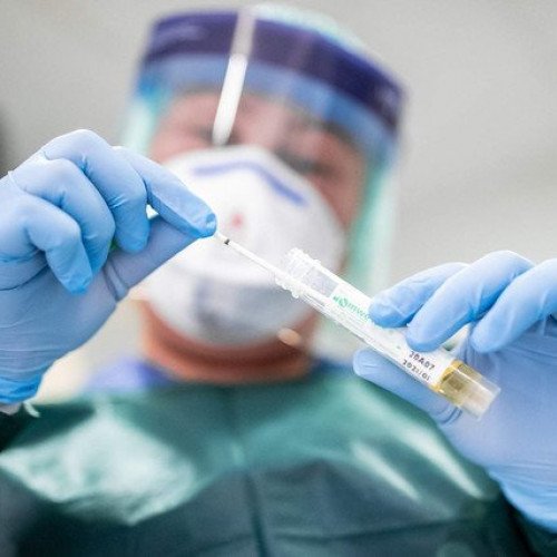 Azərbaycanda indiyədək koronavirusa görə 120 479 test aparılıb - RƏSMİ