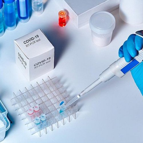 Azərbaycanda daha 57 nəfərdə koronavirus aşkarlandı - 68-i sağaldı