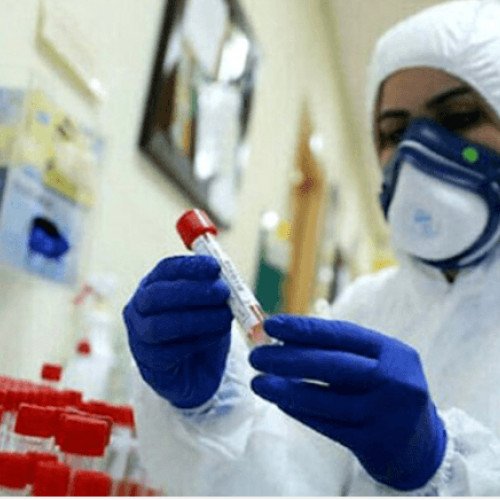Türkiyədə koronavirusdan 65 nəfər ölüb