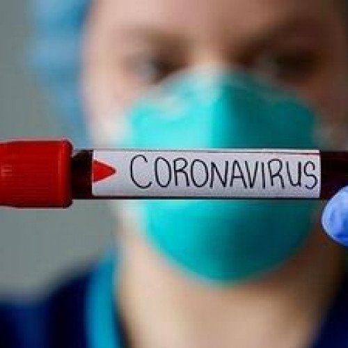 Rekord ölüm: 1 gündə 7nəfər koronavirusdan öldü