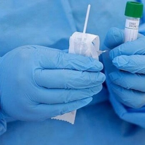 COVİD-19 testinin maya dəyəri açıqlandı - RƏSMİ