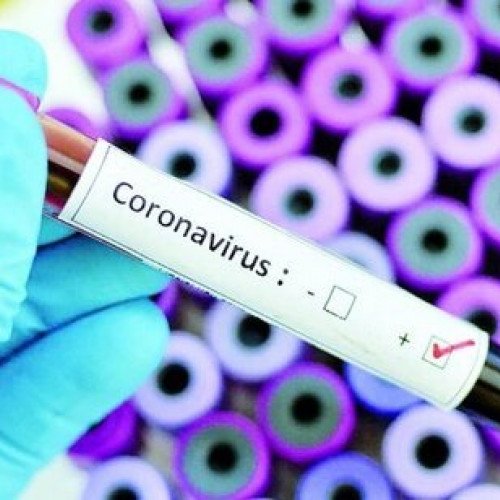 Daha 517 nəfərdə koronavirus aşkarlandı - 7 pasiyent öldü