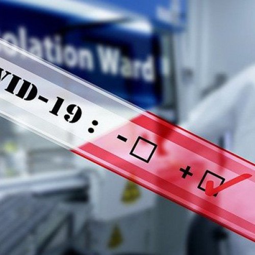 Daha 438 nəfərdə koronavirus aşkarlandı - 4 nəfər vəfat etdi