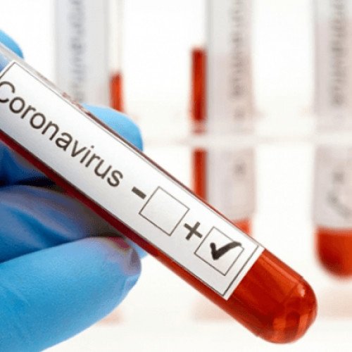 Prokuror koronavirusa yoluxub