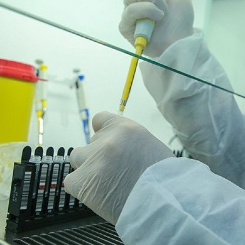 Özəl klinikalarda koronavirus testinin qiyməti açıqlandı
