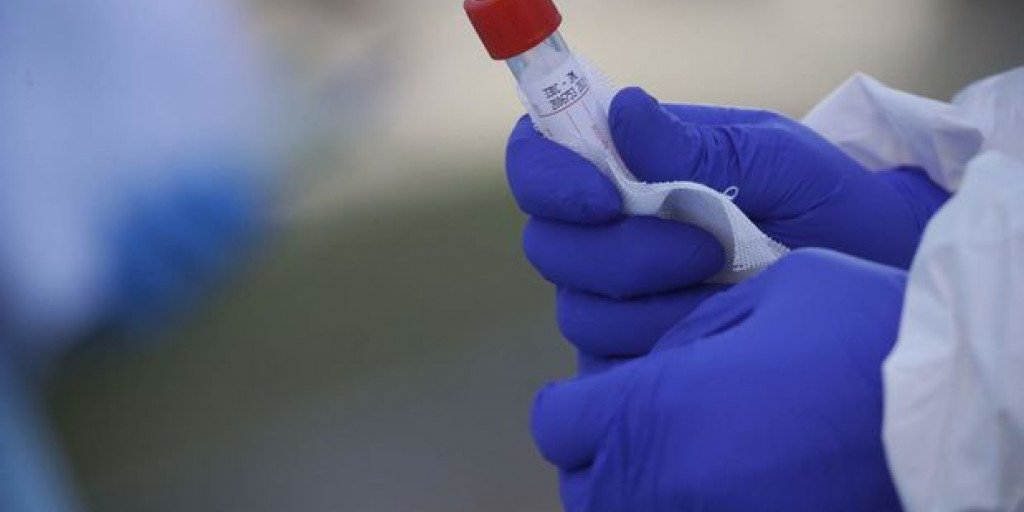 Azərbaycanda ekspress koronavirus testlərinin istifadəsindən imtina edildi - RƏSMİ