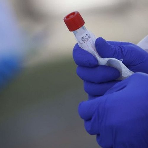 Azərbaycanda ekspress koronavirus testlərinin istifadəsindən imtina edildi - RƏSMİ