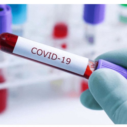 Daha 471 nəfər koronavirusa yoluxub və 5 nəfər ölüb